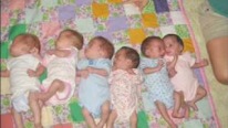 Bir Doğumda 6 Bebek Rekoru